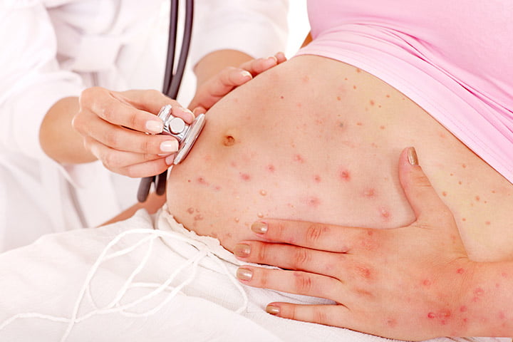 Pregnancy infections 01