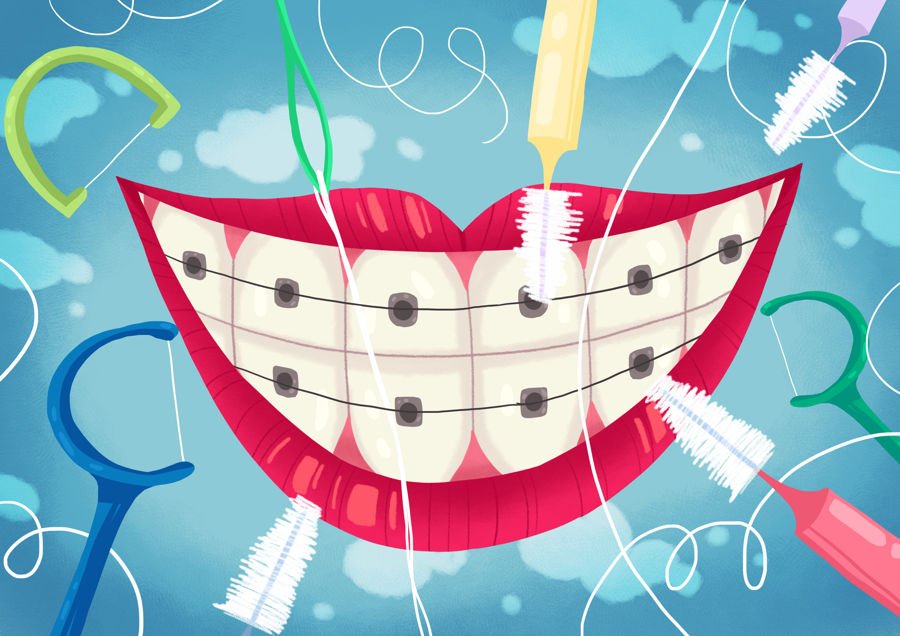 Sabka Dentist Tells You How To Take Care Of Children’s Teeth With Braces