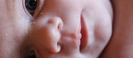 Home remedies for prickly heat - baby face with heat rashes