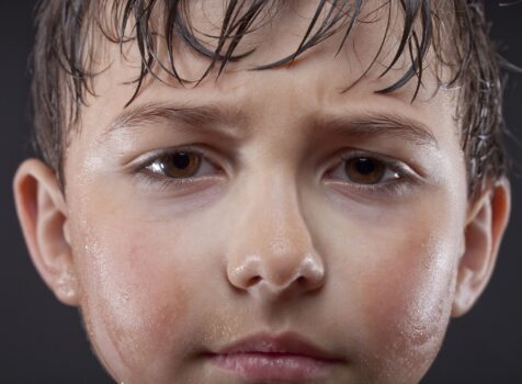 3 Main Causes Of Excessive Sweating In Kids – What’s Hyperhidrosis?