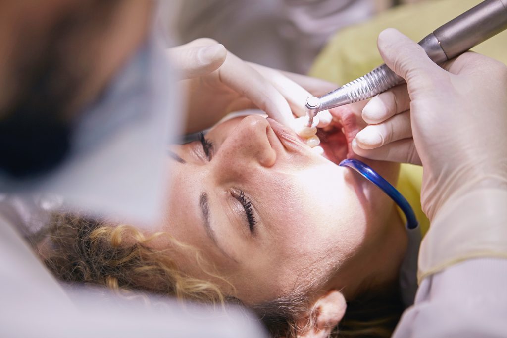 Tartar on Teeth - Dentist removing tartar