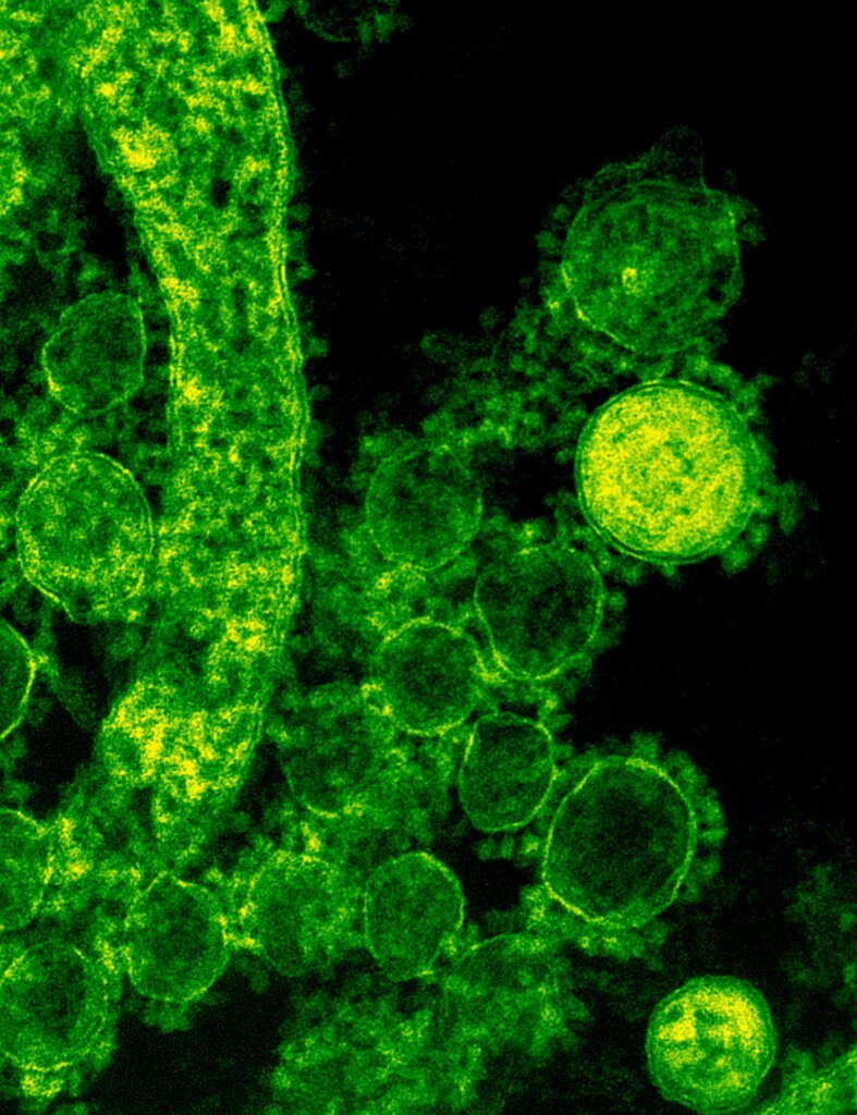 Nipah virus under microscope